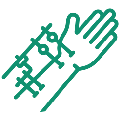 External Fixation-01