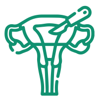 Hysterotomy – Vaginal & Abdominal-01