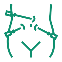 Laparoscopic Hysterectomy-01