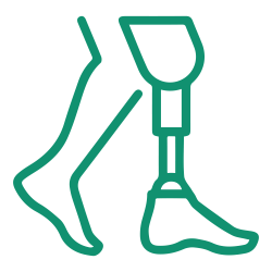 Limb Reconstruction Surgery-01